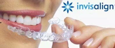 成人矫正隐适美牙齿视频,见证微笑蜕变之旅-第1张图片-同人3d动漫