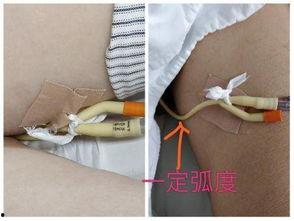 怎么拔出成人尿管图片视频-第1张图片-同人3d动漫