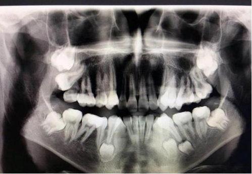 怎么拔出成人尿管图片视频-第2张图片-同人3d动漫