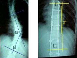 成人脊柱牵引图片视频,揭秘成人脊椎健康恢复之道-第2张图片-同人3d动漫