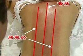 成人退热刮痧视频大全,成人退热刮痧视频大全精华解析-第3张图片-同人3d动漫 成人退热刮痧视频大全,成人退热刮痧视频大全精华解析-第3张图片-同人3d动漫