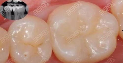 成人补牙事故视频大全最新,视频大全警示录-第3张图片-同人3d动漫